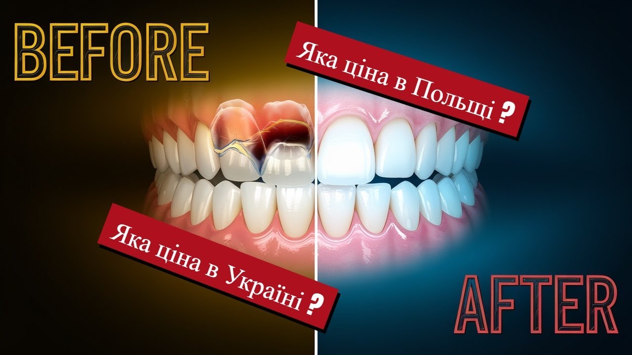 Скільки НАСПРАВДІ коштує стоматологія в Польщі?