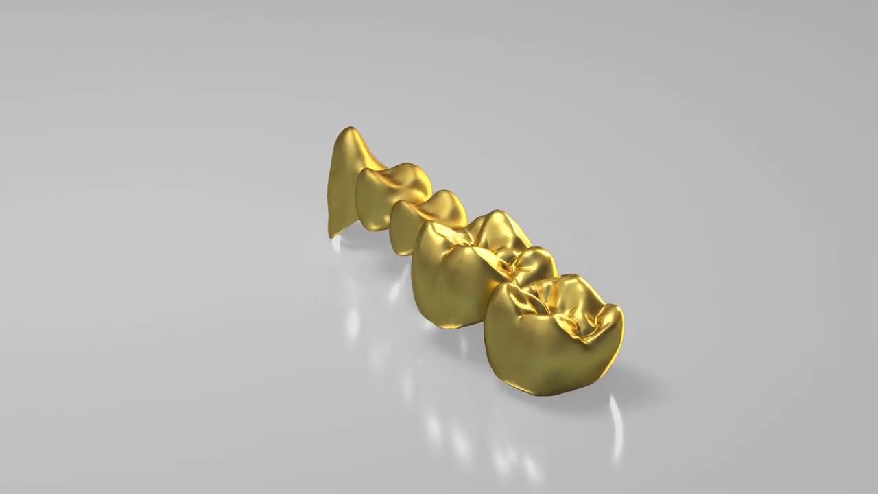 C.HAFNER Edelmetall Dentaltechnologie &ndash; cehaGOLD&reg; &ndash; Fr&auml;sen in Edelmetall