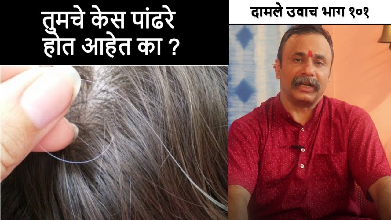 तुमचे केस पांढरे होत आहेत का ? / दामले उवाच भाग 101 / Grey Hair Remedy / Damle Uvach 101