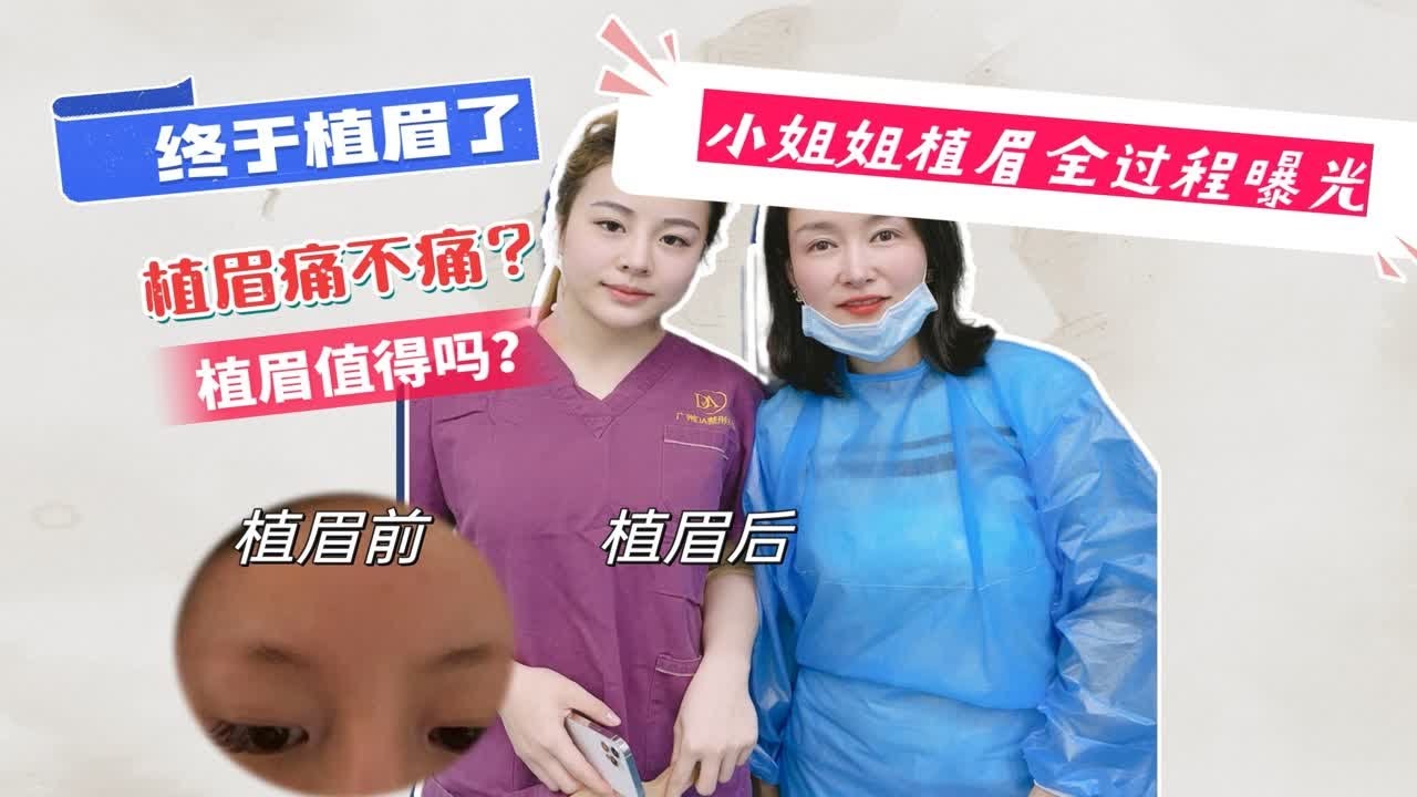终于植眉了！小姐姐眉毛种植植眉全过程大曝光