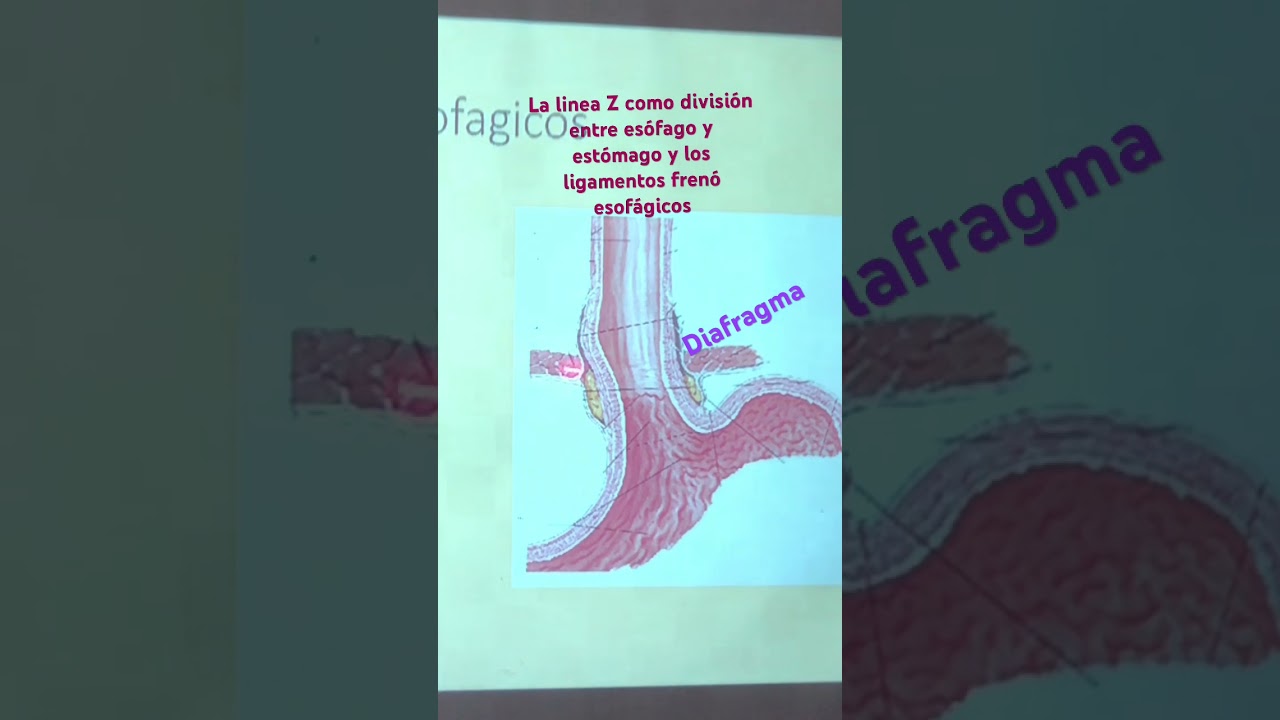 #ligamentos