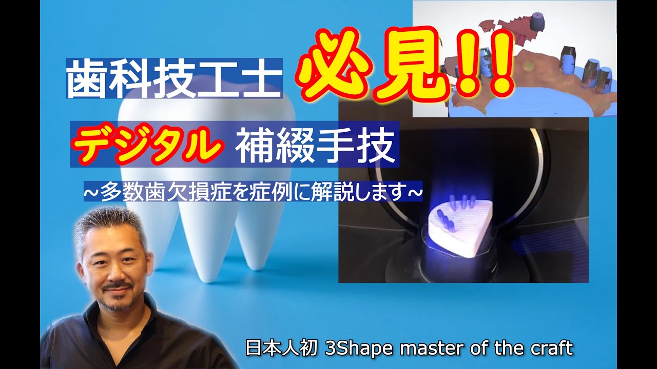 多数歯欠損症例をデジタルアプローチで行う