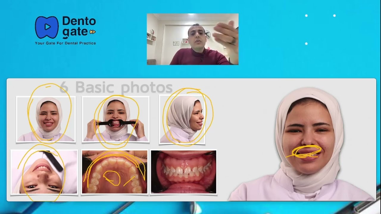 smile Analysis