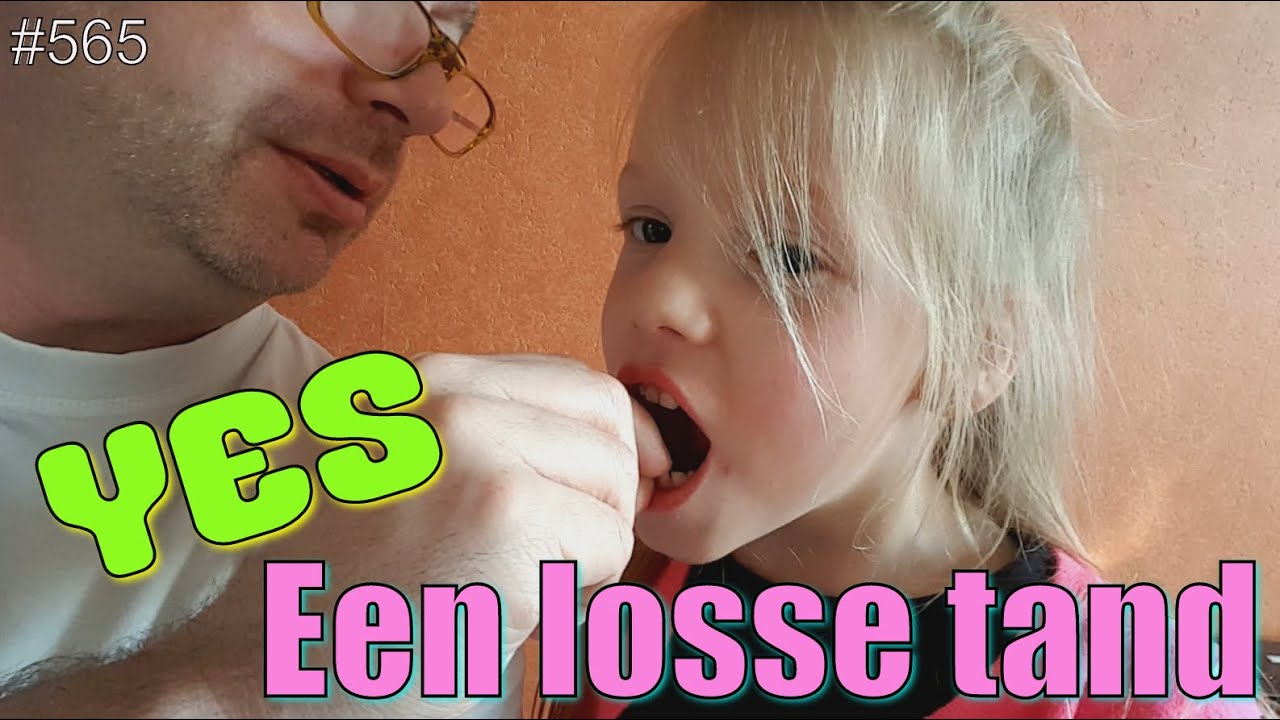 Mijn eerste losse tand vraagt veel aandacht bij de familie. Nu hij los zit, moet hij eruit!. #565