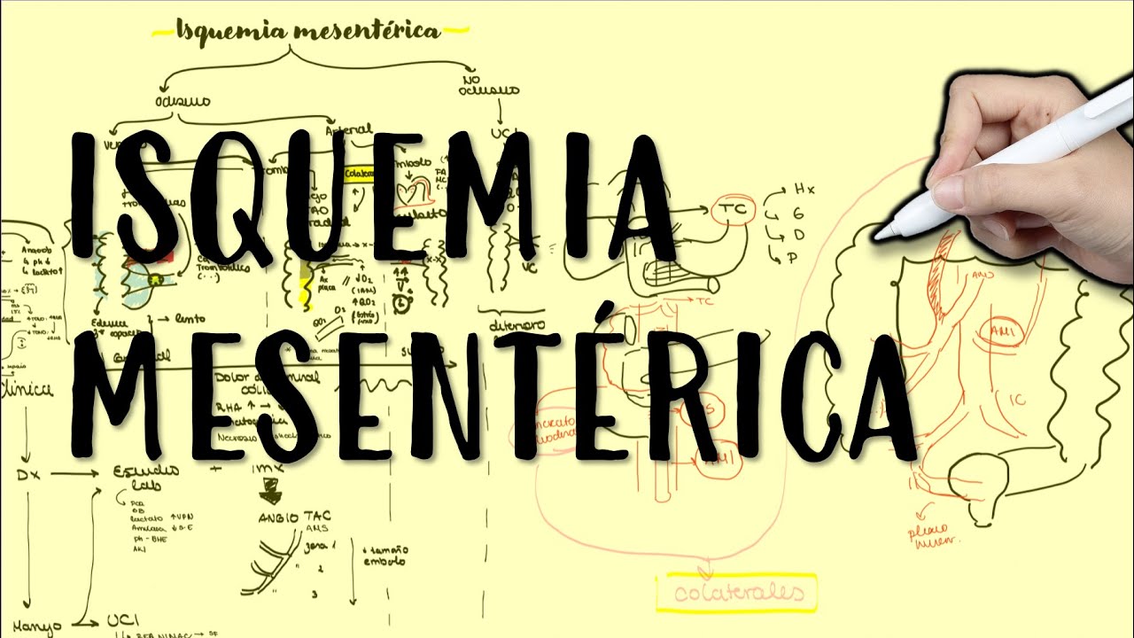ISQUEMIA MESENTERICA #oclusiva #claudicacion #trombosis #embolo #shock #aguda #cronica