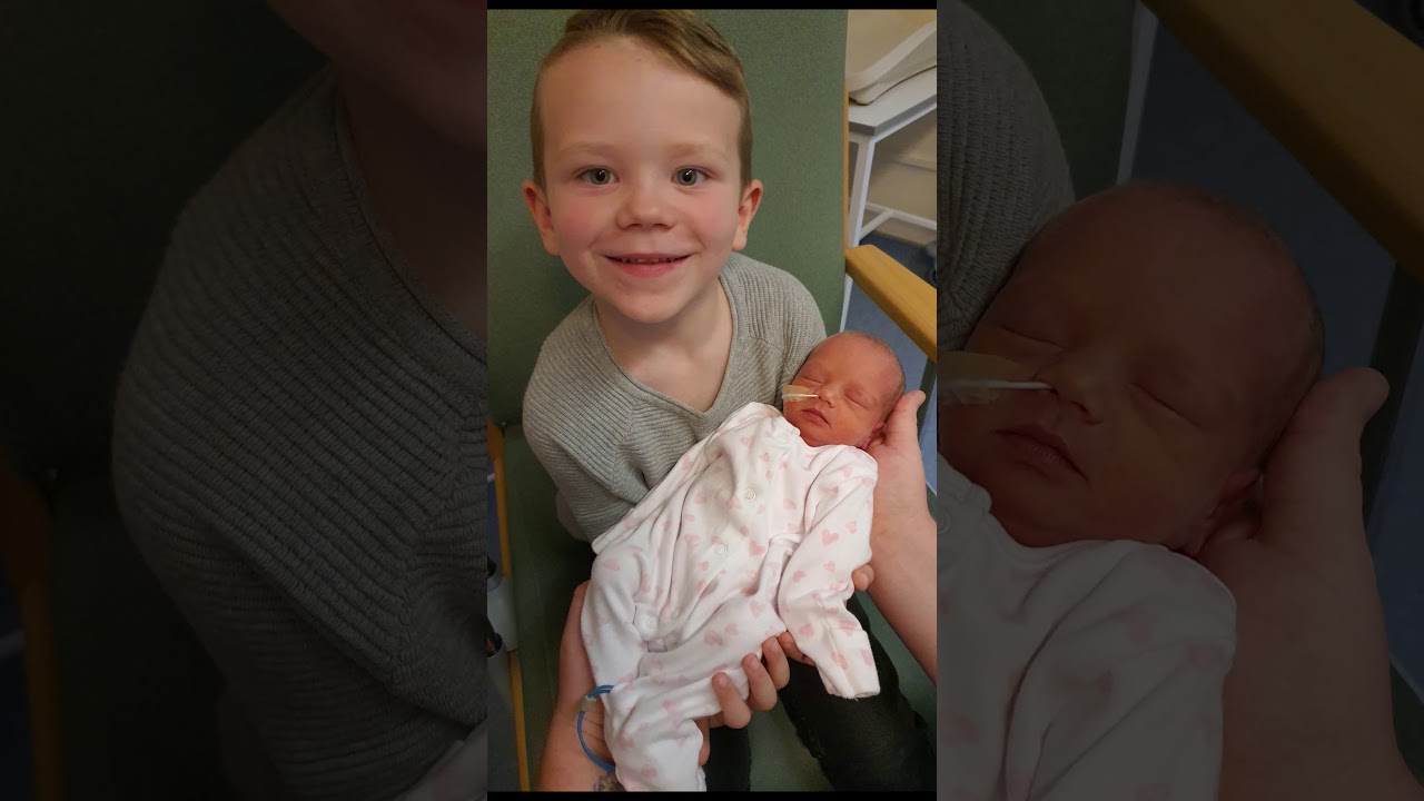 Twin Birth Story and our Journey with Bilateral MCDK