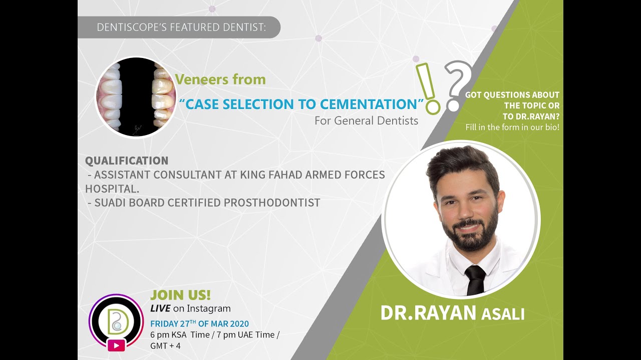 Live Streaming | Veneers from Case Selection to Cementation