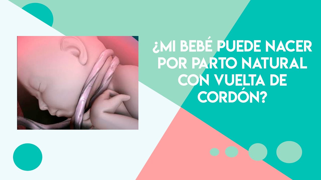 Es posible un parto natural si el beb&eacute; tiene el cord&oacute;n umbilical enrollado?