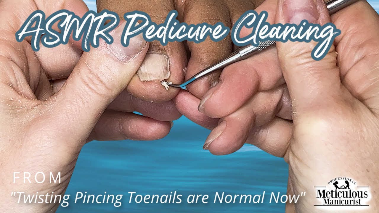 👣ASMR Pedicure Cleaning💆&zwj;♀️Twisting Pincing Toenails are Normal Now👣