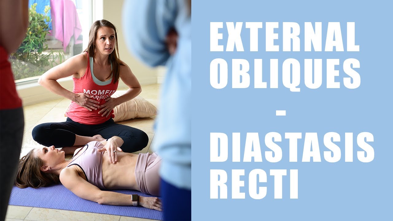 External Obliques and Diastasis Recti