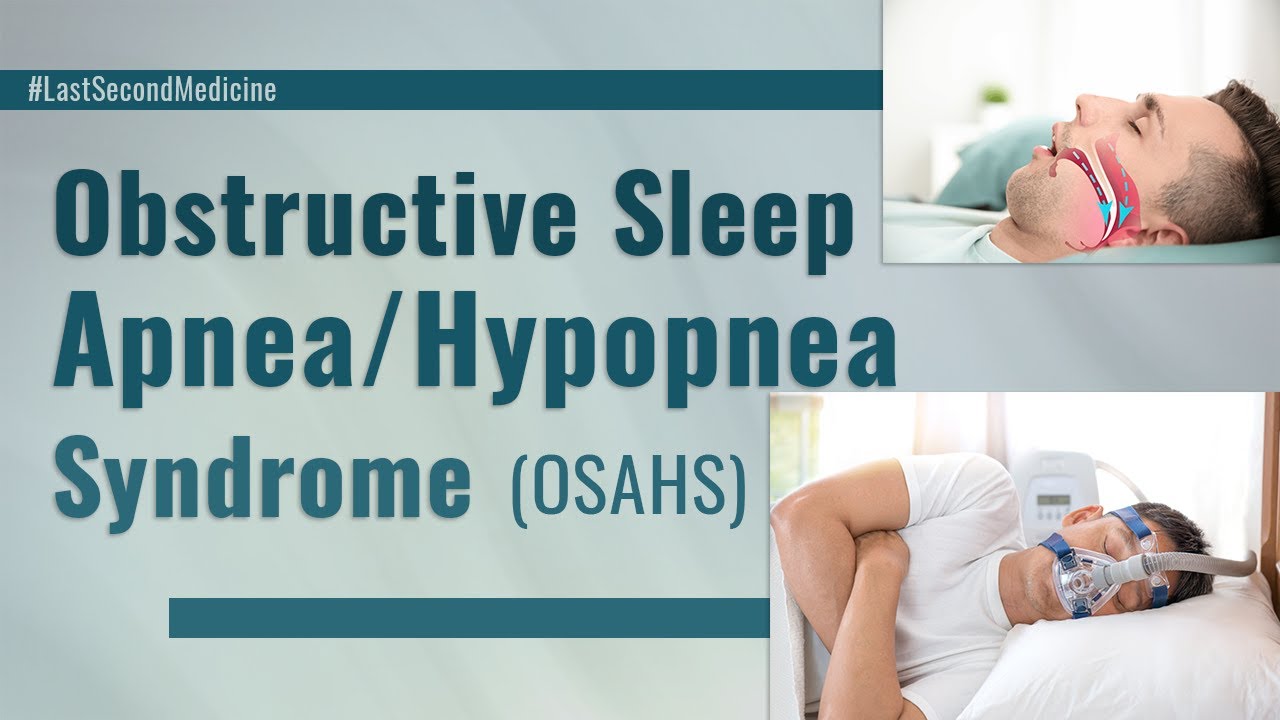Obstructive Sleep Apnea Hypopnea Syndrome - What is it, its diagnosis and treatment (EXPLAINED)