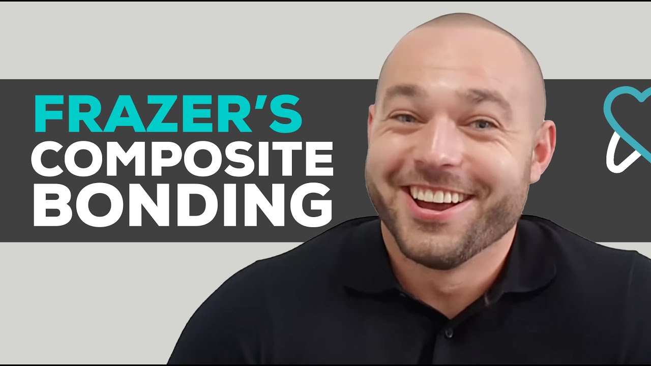 Frazer' Composite Bonding Journey | Ryton Dental