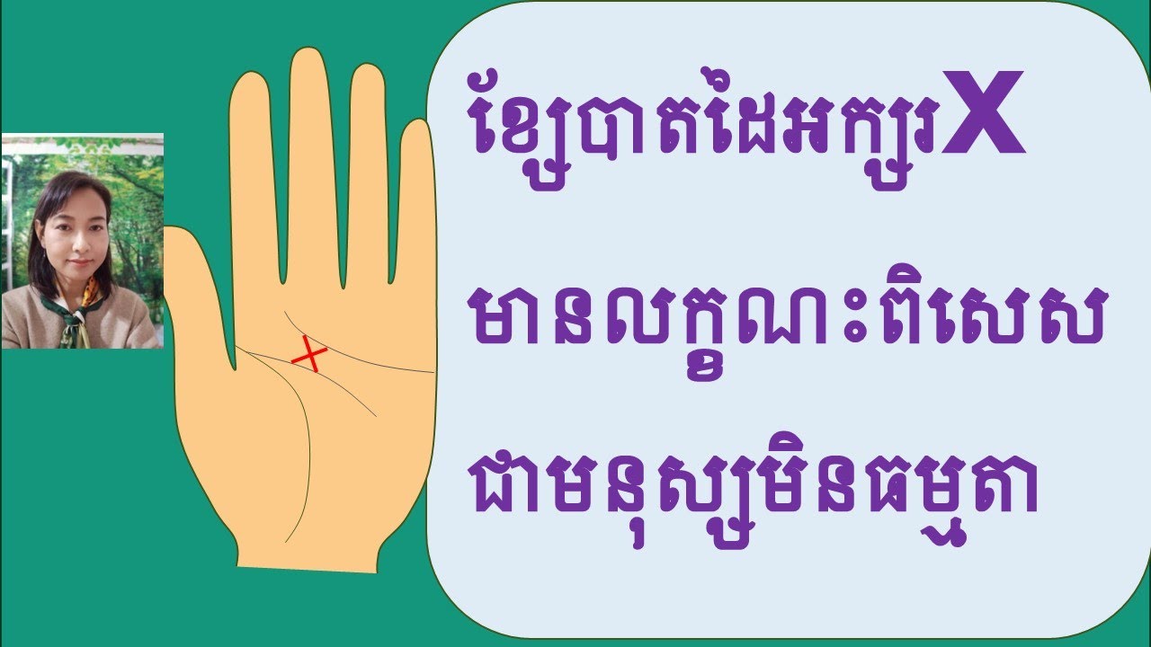 ខ្សែបាតដៃអក្សរXជាខ្សែល្អអស្ចារ្យ