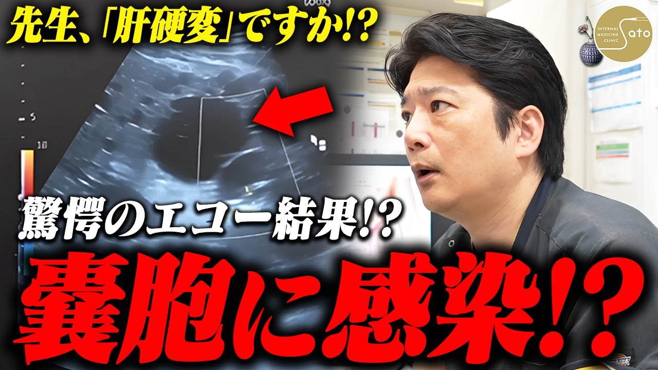 【驚愕】『巨大な嚢胞に感染！？』まさか「マンジャロ」が原因か！？ 医師が