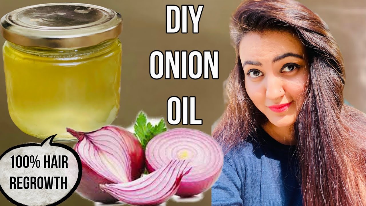 DIY Onion Oil At Home : झड़े हुए बालों को फिर से उगाएं, Hair Fall रोकें और पाएं Faster Hair Growth