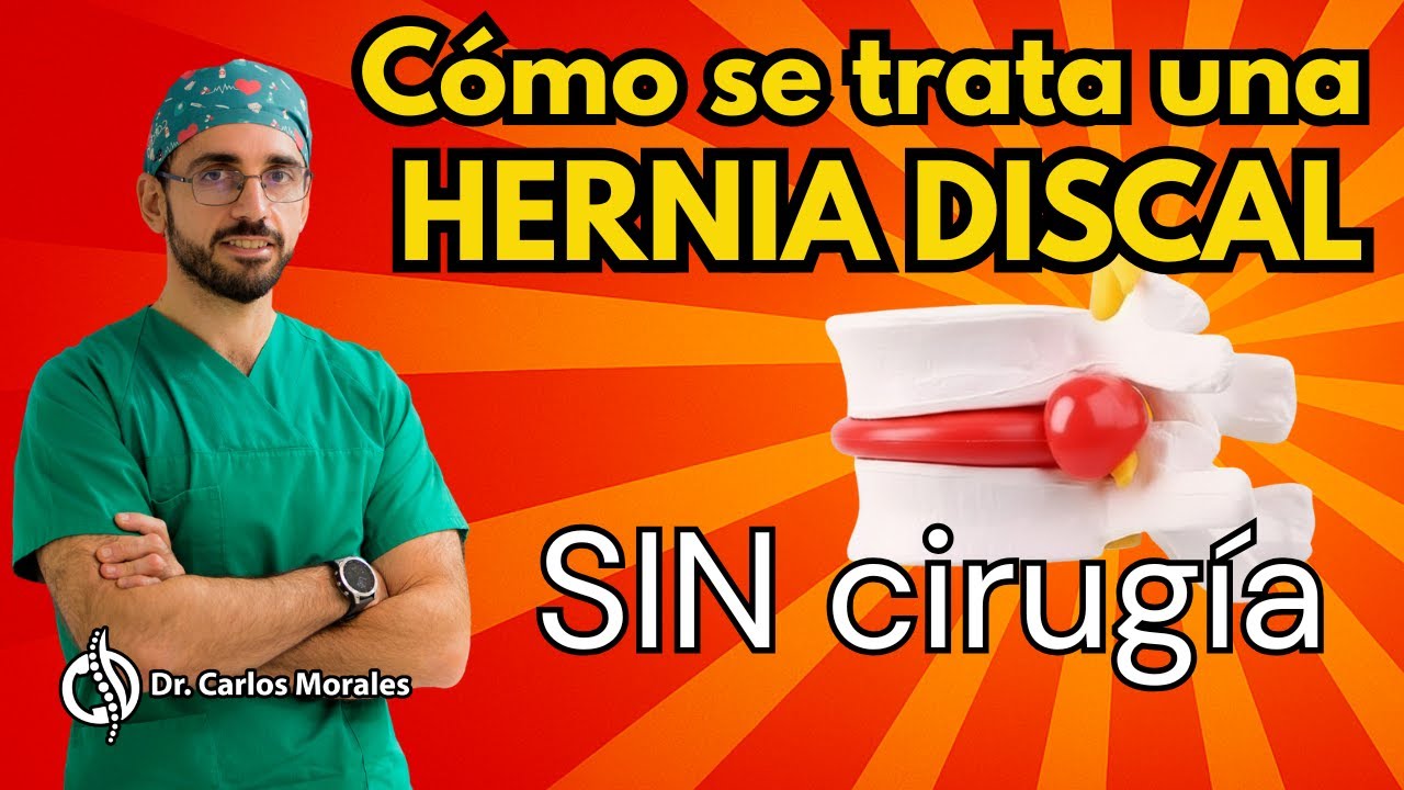📌 ¿Hernia Discal? Descubre Cuándo la Cirugía es Realmente Necesaria 🤔