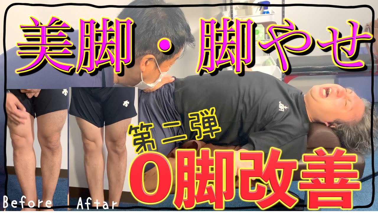【O脚改善・美脚・脚やせ】まっちゃんのO脚を１５分で治す瘢痕削り第２弾｜まっちゃんのO脚は改善するのか？！