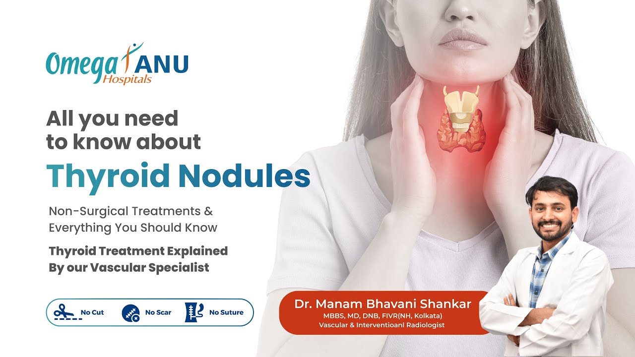 Thyroid Nodule Explained. Do You Need Surgery? Symptoms, Risk, fnac & Non-Surgical Treatment