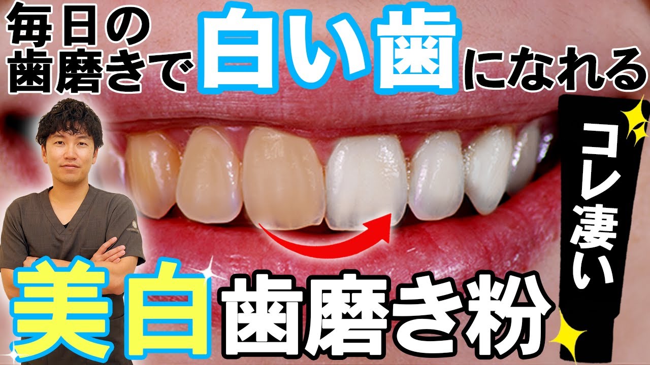 【歯を白くする方法】歯医者が本気で選んだ美白歯磨き粉TOP3！