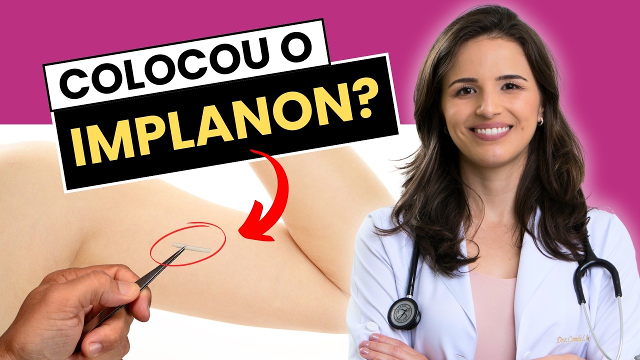 ACABOU DE COLOCAR O IMPLANON? NÃO IGNORE ESTES CUIDADOS ESSENCIAIS!