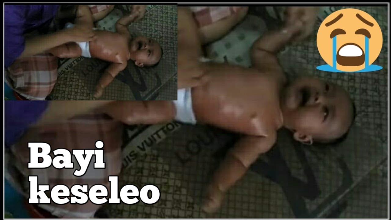Bayi Keseleo Di Pijat Nangis Kejer || Dede aL