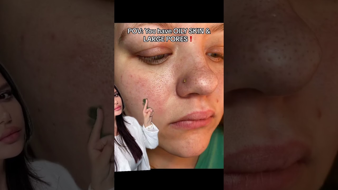 Do you have OILY SKIN & LARGE PORES?! #skincare #skincareroutine