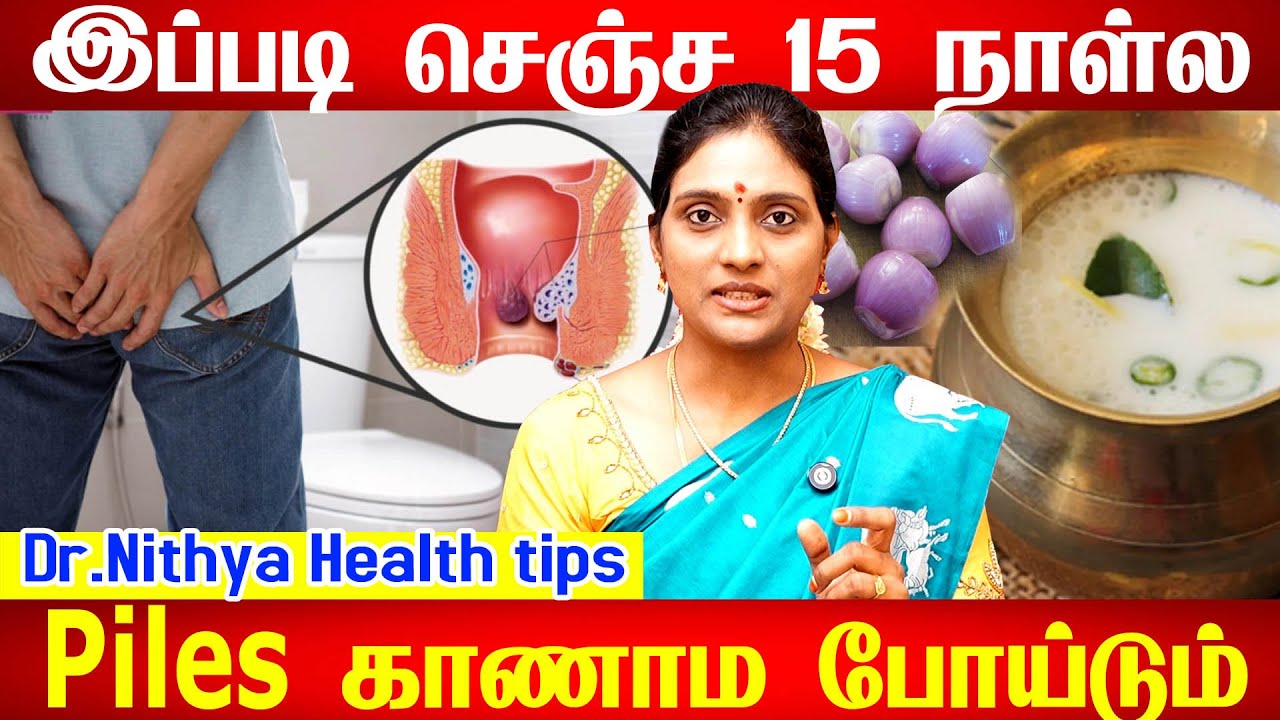 Piles குணமாக இயற்கை மருத்துவம் Top 5 Tips to cure PILES Permanently | மூல நோய்க்கு  நிரந்தர தீர்வு