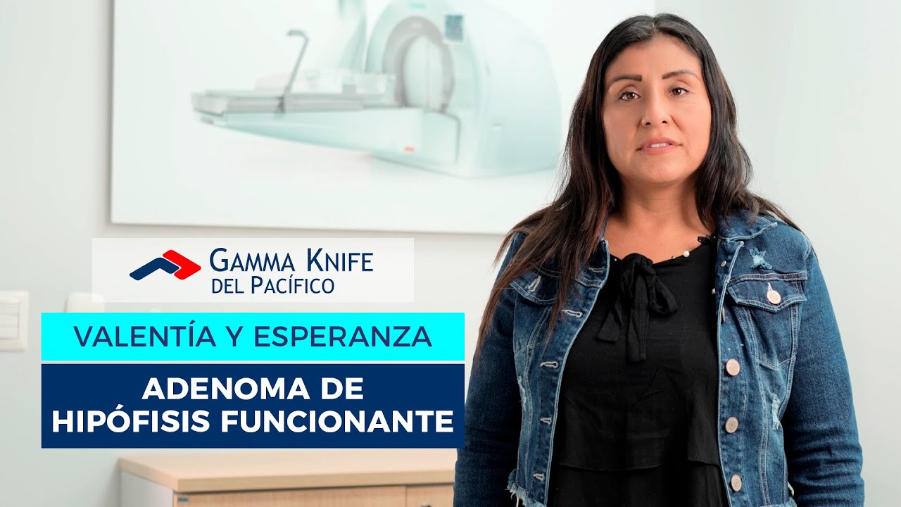 Testimonio de Jessica Jeremías: Adenoma de Hipófisis Funcionante. enfermedad de Cushing