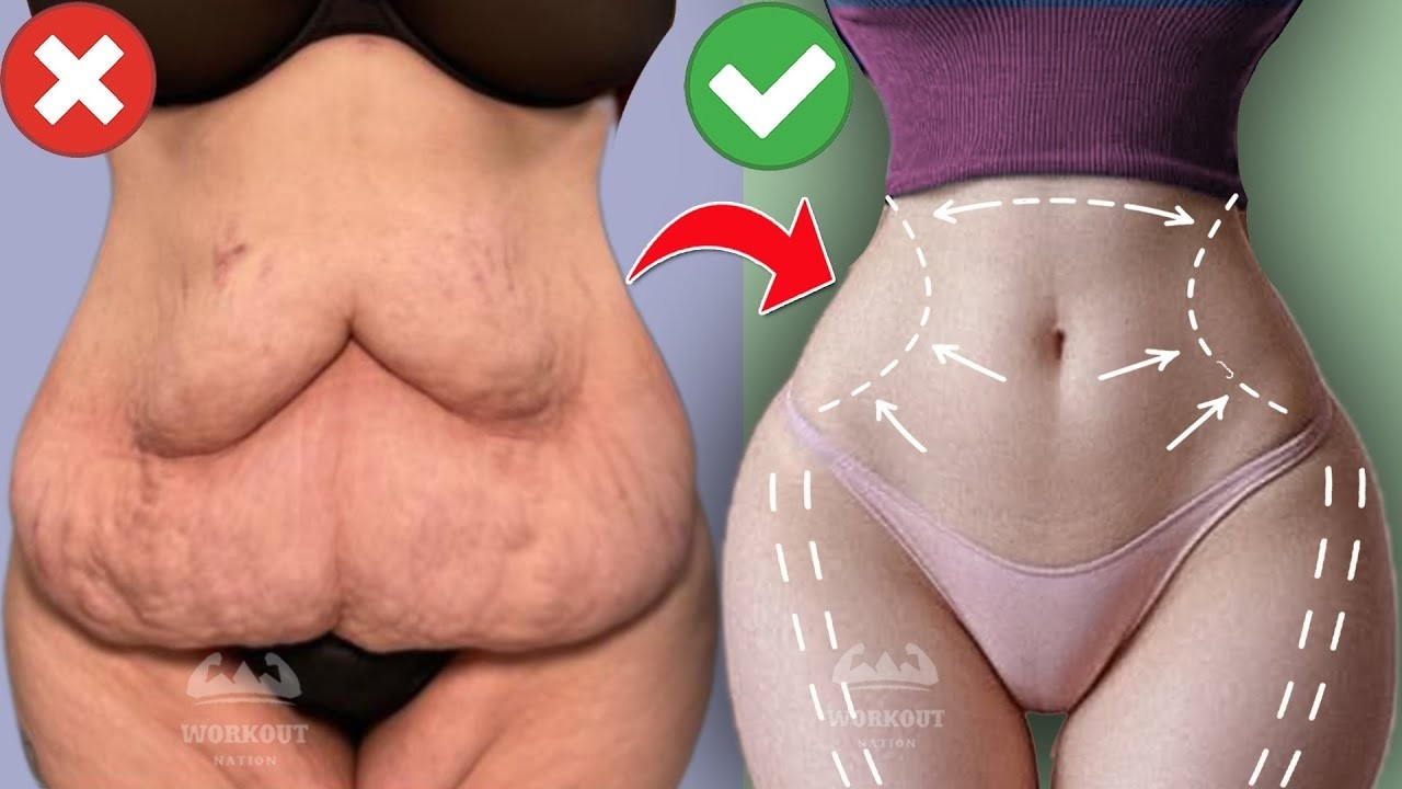 Me dê 20 min e eu vou DESTRUIR sua GORDURA da barriga