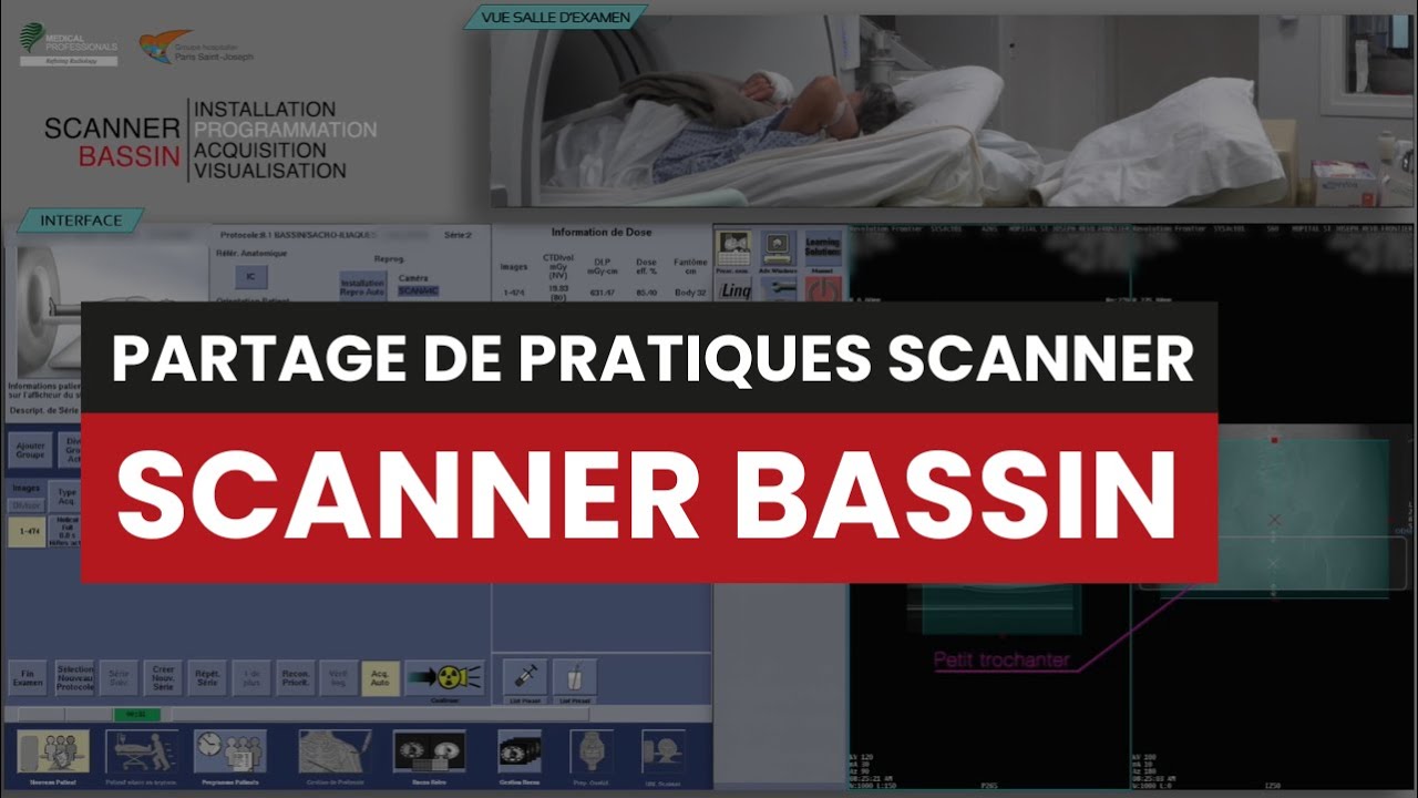 CT SCANNER BASSIN - Partage de pratique