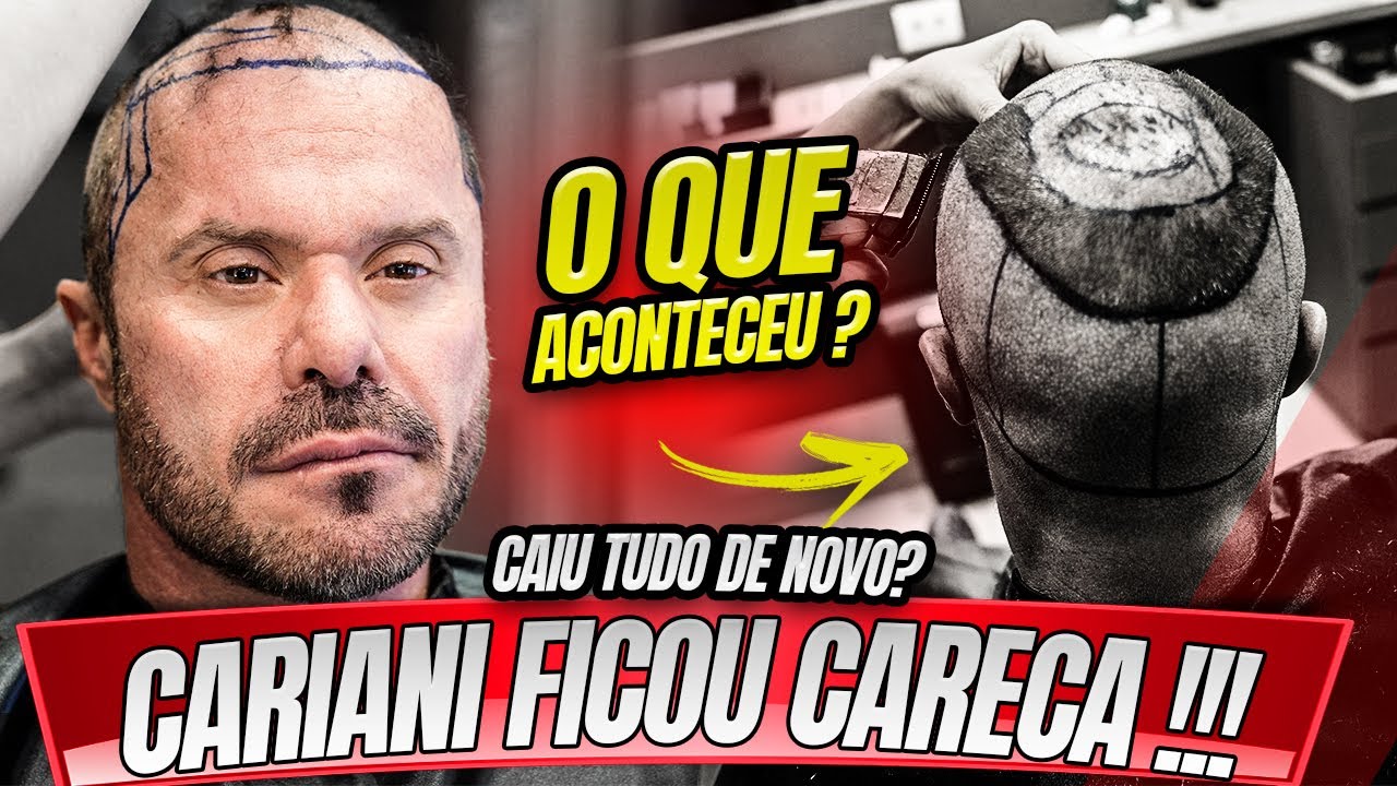 CARIANI FICOU CARECA DENOVO !!! O QUE ACONTECEU ?