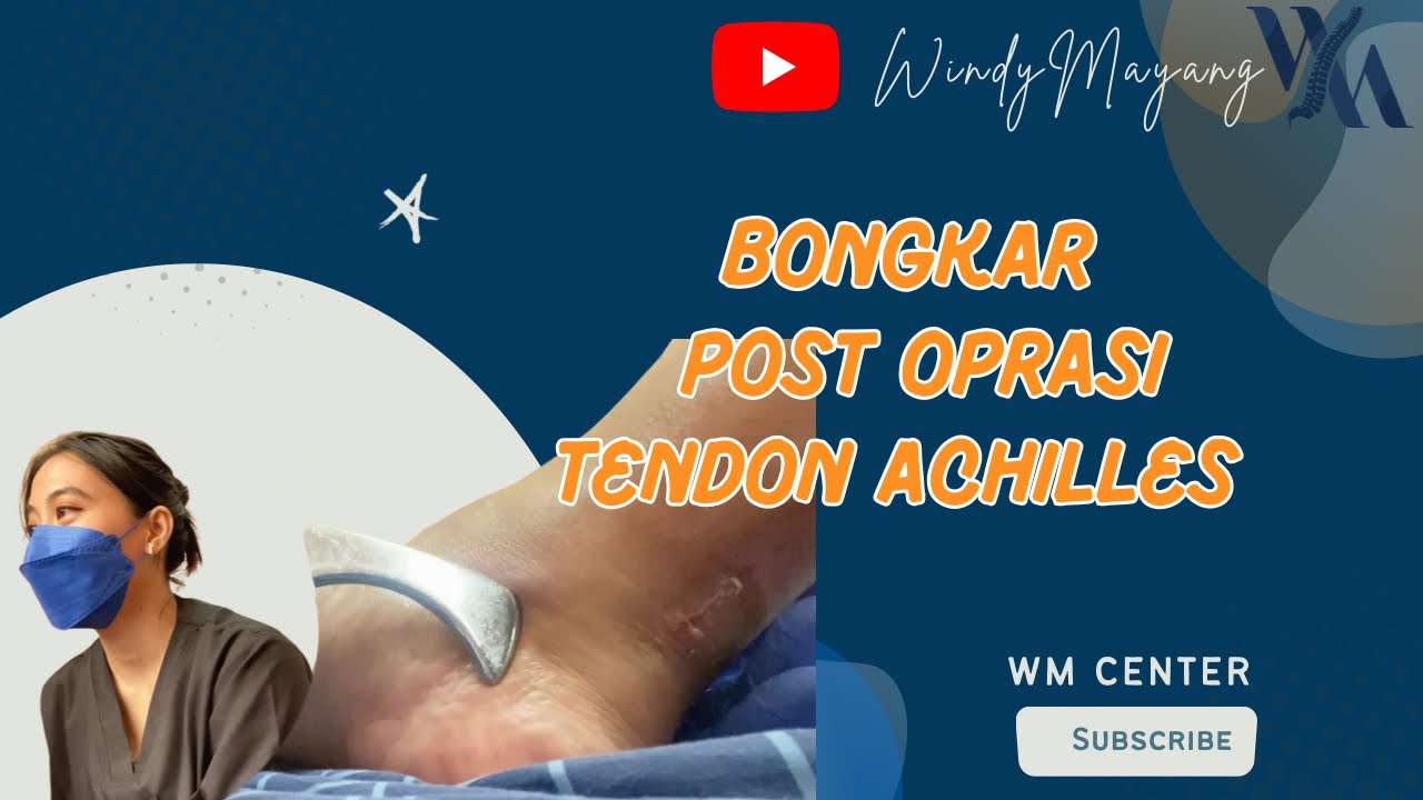 CARA PENANGANAN SETELAH OPRASI TENDON ACHILLES ..