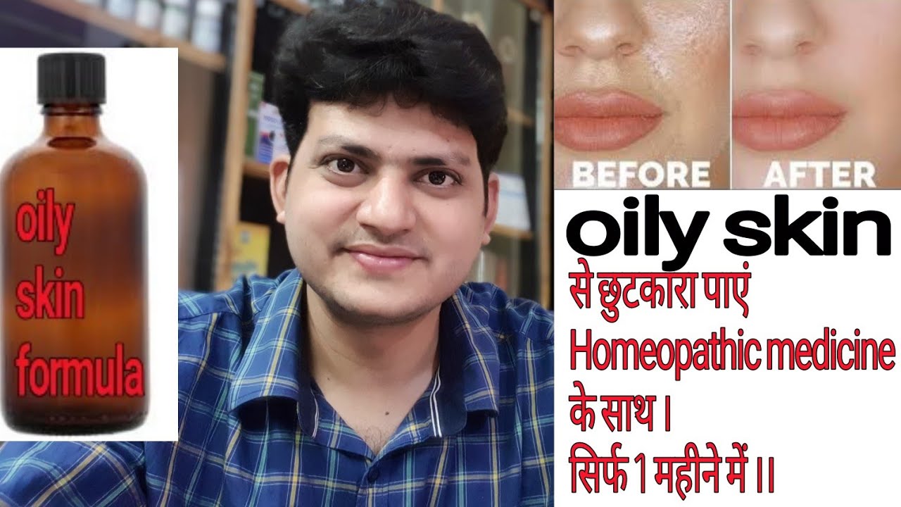 Homeopathic Medicine for oily skin ? with My Formula !
