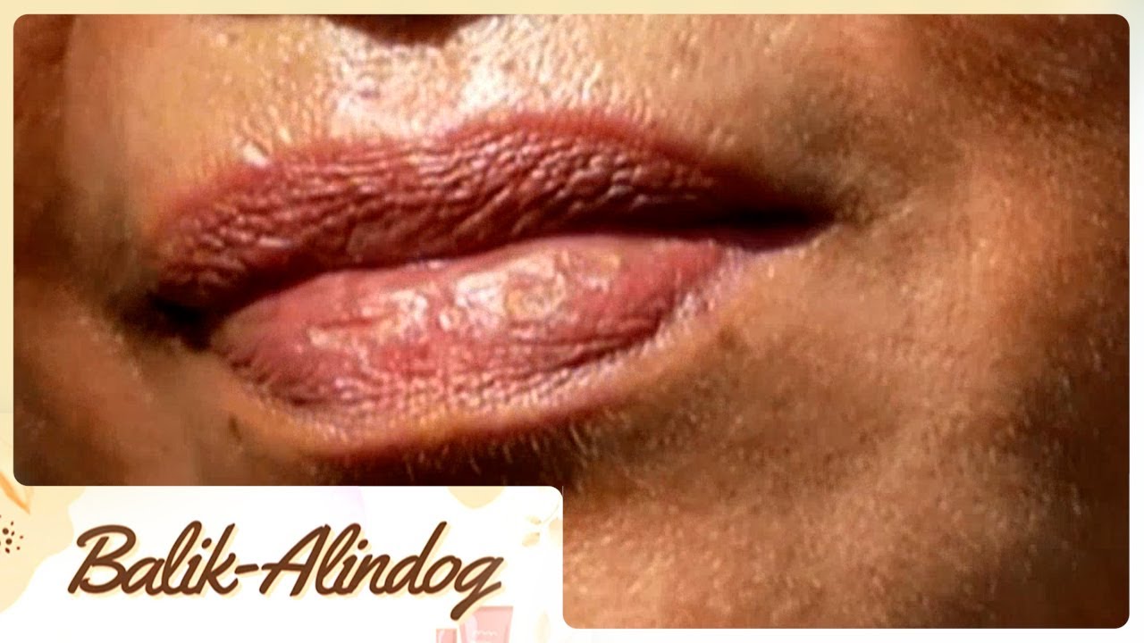 Balik-Alindog: Nagbabalat na labi o chapped lips | Gud Morning Kapatid