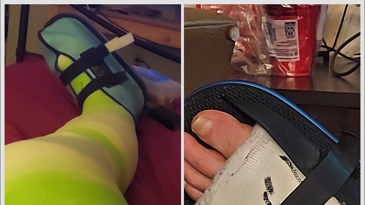 Product Reviews, Cast Care: The Best Open and Closed Toe Cast Shoes