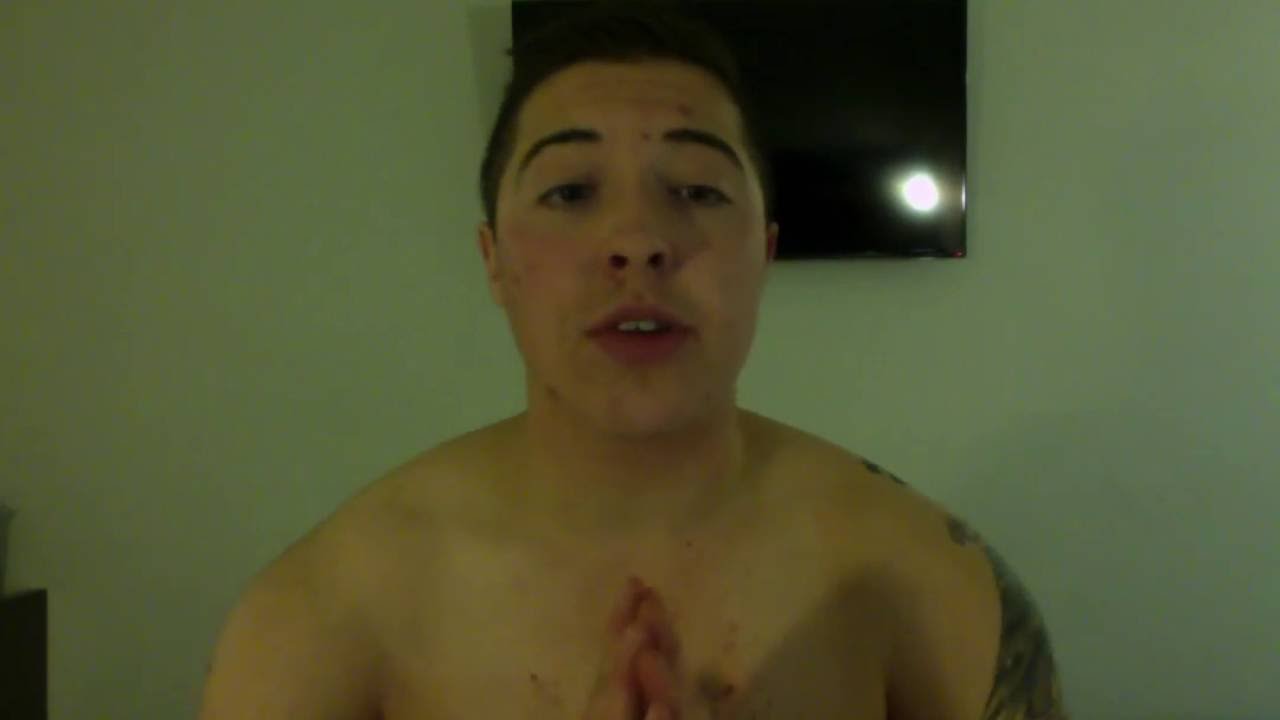 Top Surgery Sydney Steve Merten - pre-op