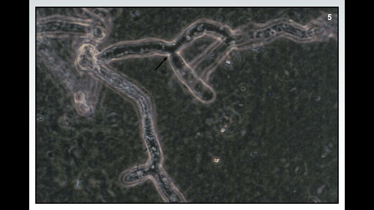 Fundamentals of Plant Diseases - Slide 5 - FUNGI:  HYPHAE