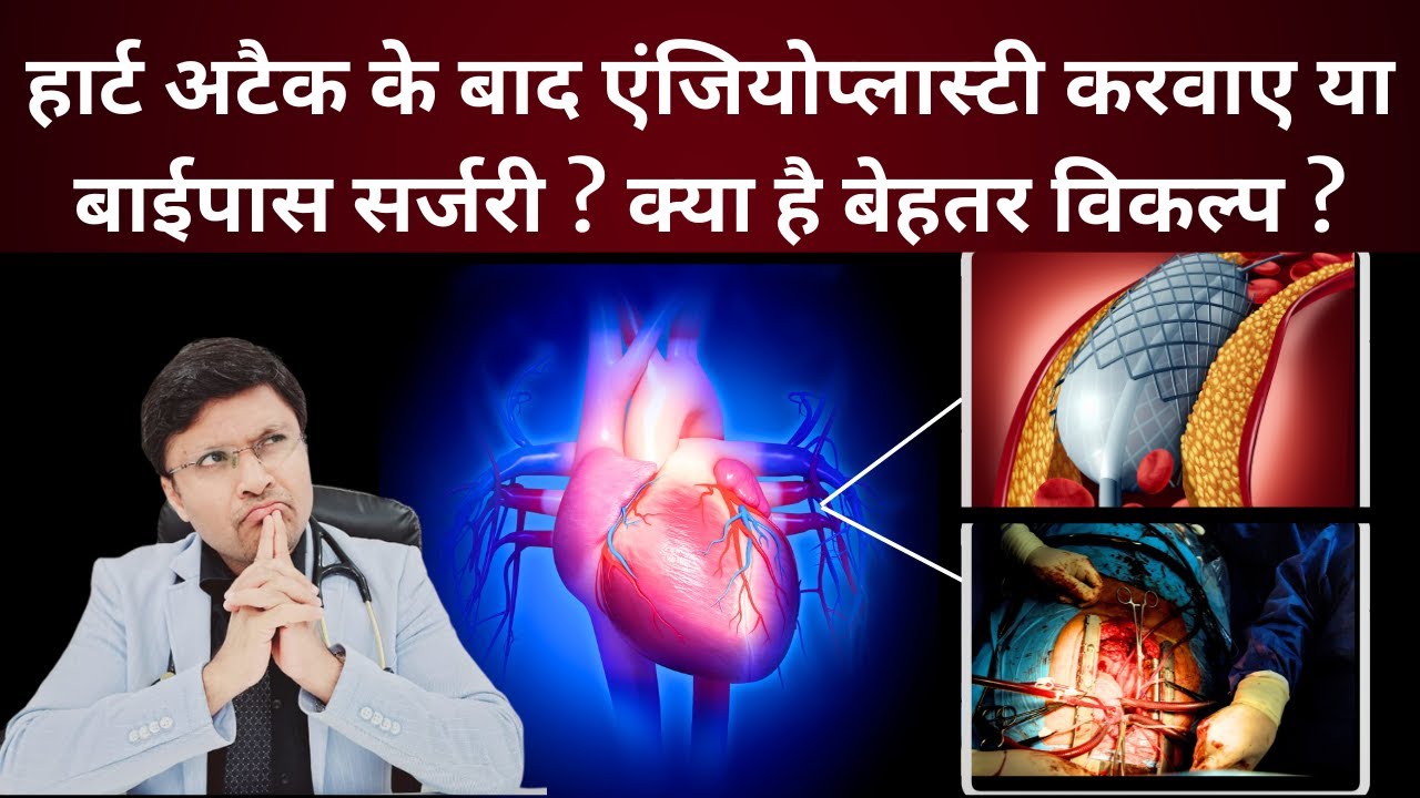 Angioplasty vs Bypass Surgery Comparative analysis..?Which is better for you.?