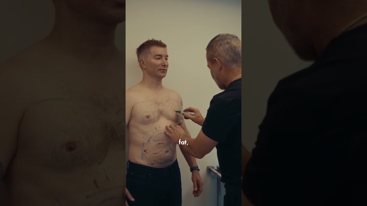 Men's Chest Fat - Liposuction