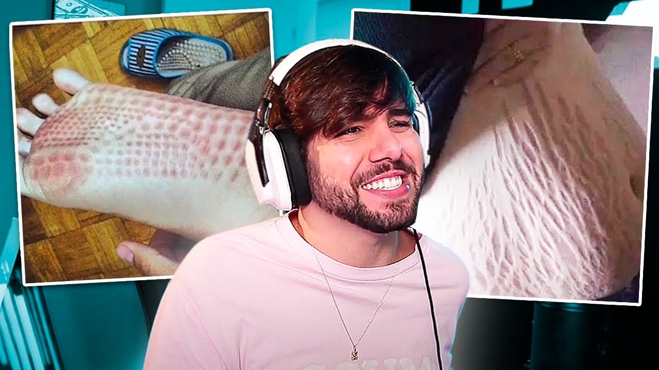 Teste se voc&ecirc; tem essas FOBIAS