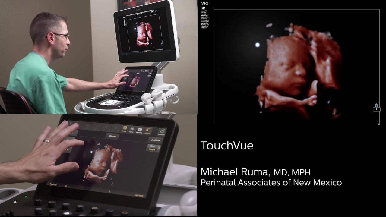 Philips TrueVue, TouchVue, MPR Touch, GlassVue, aReveal