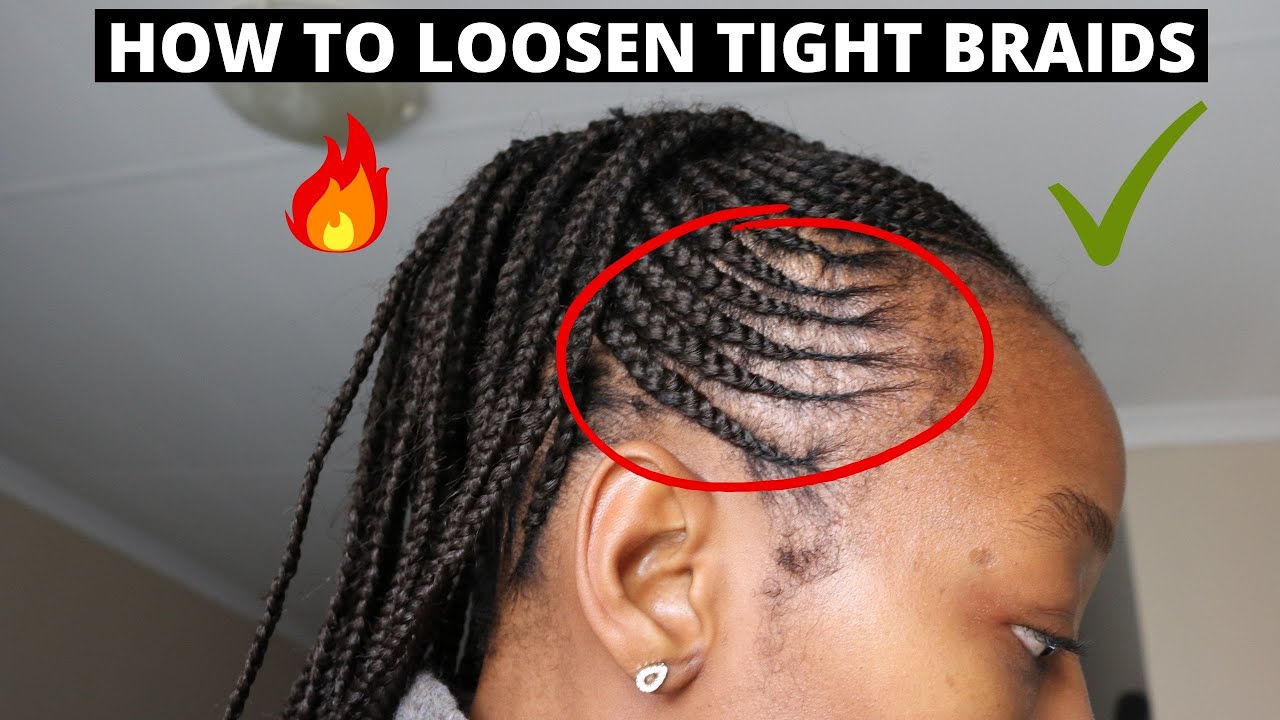 HOW TO LOOSEN TIGHT BRAIDS FAST
