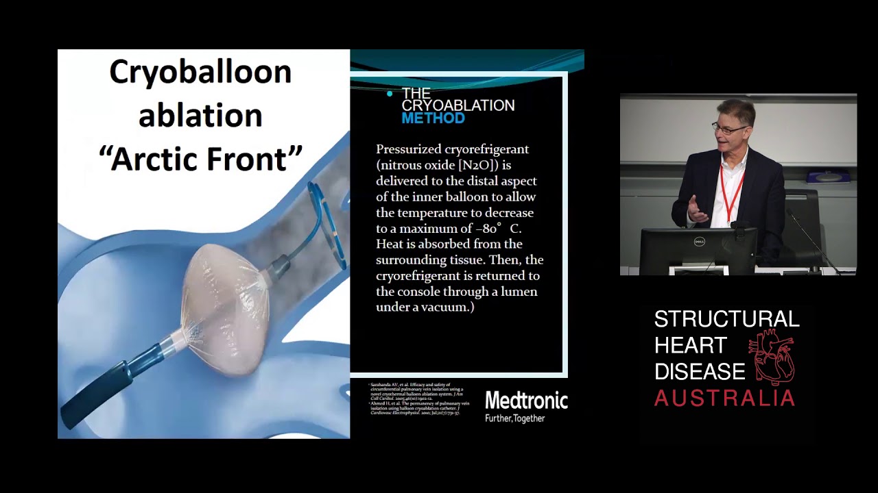 Atrial Fibrillation Ablation: Radiofrequency vs Cryoballoon - Dr David Whalley