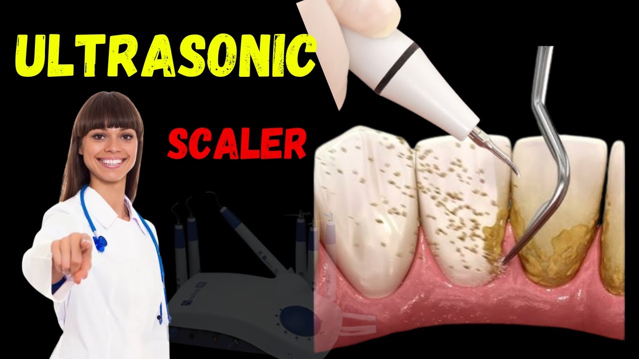 What is Ultrasonic Scaler | Ultrasonic Scalers: Function and Benefits