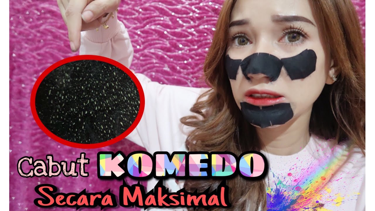 Cabut KOMEDO secara MAKSIMAL || Marisha Chacha