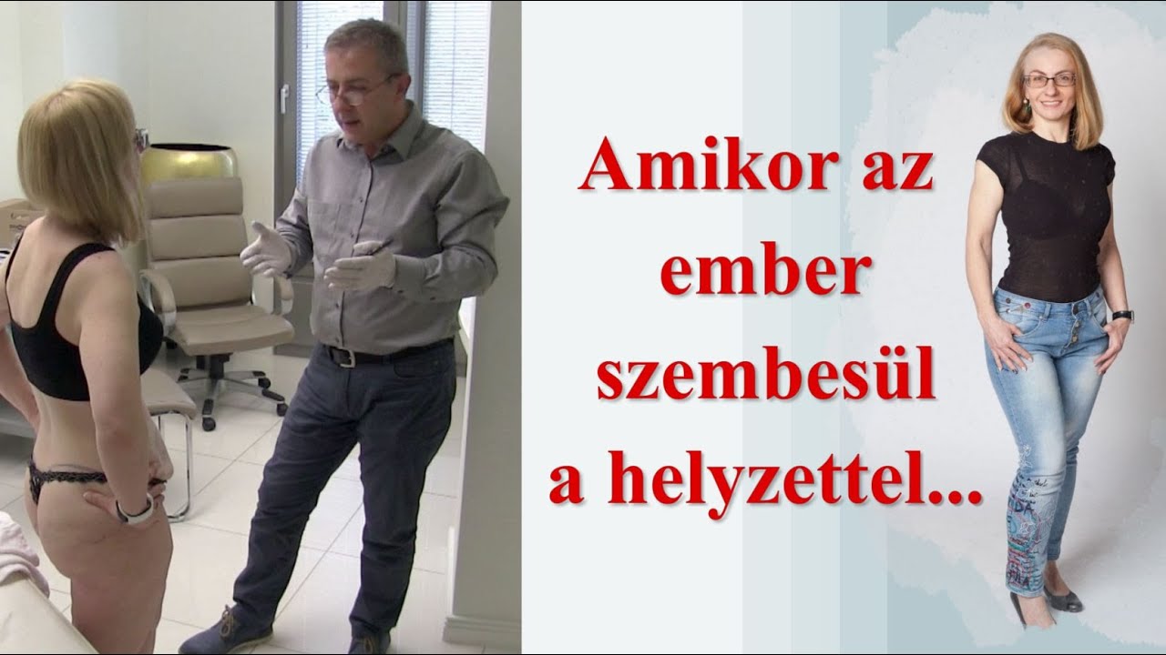 Hasplasztika konzultáció - vagyis amikor összefirkálták a hasam