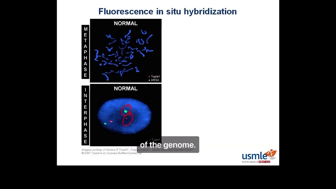 Fluorescente in situ hybridization USMLE Step 1