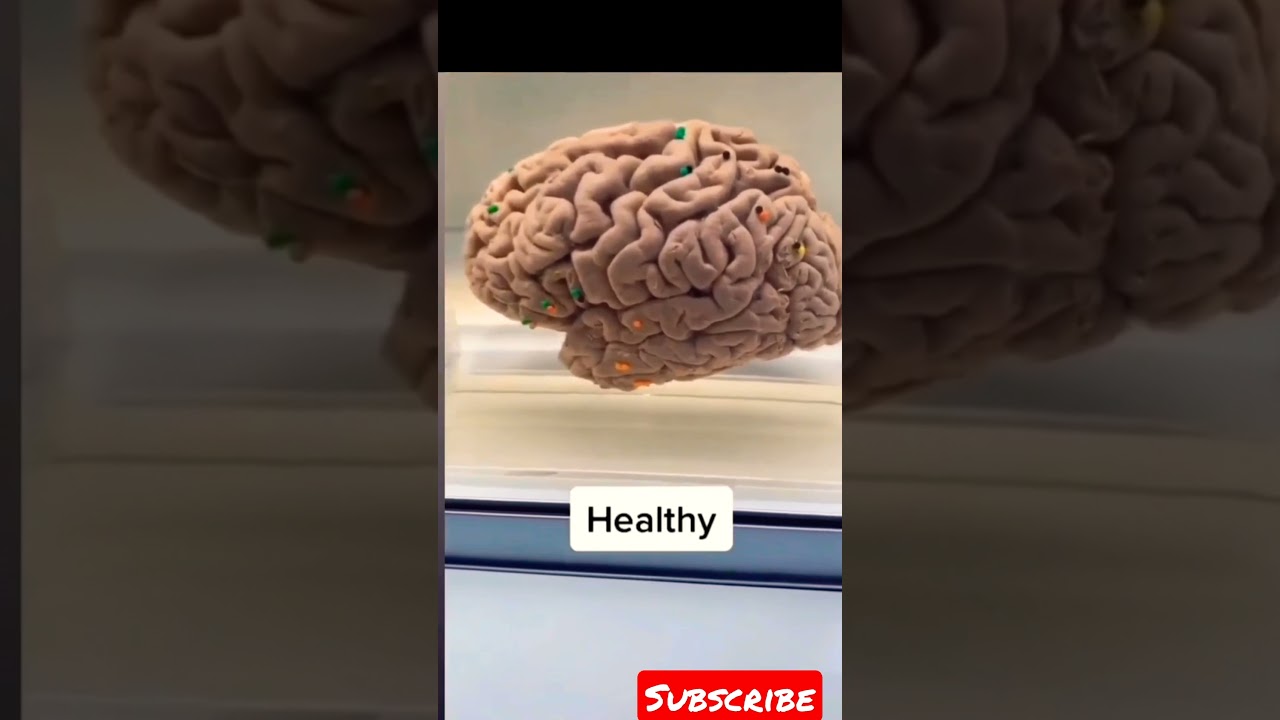introduction neurology video lab brain Dissection Literature Subject #short  #brianmclogan