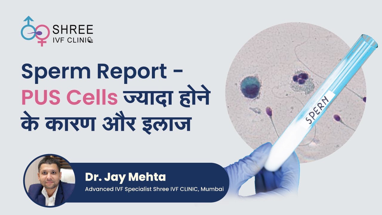 Sperm Report - PUS Cells ज्यादा होने के कारण और इलाज | Causes of abnormal PUS Cells | Dr Jay Mehta