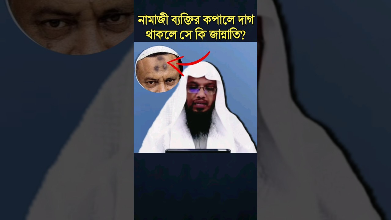 নামাজী ব্যক্তির কপালে দাগ থাকলে সে কি জান্নাতি? শায়খ আহমাদুল্লাহ #sheikh_ahmadullah
